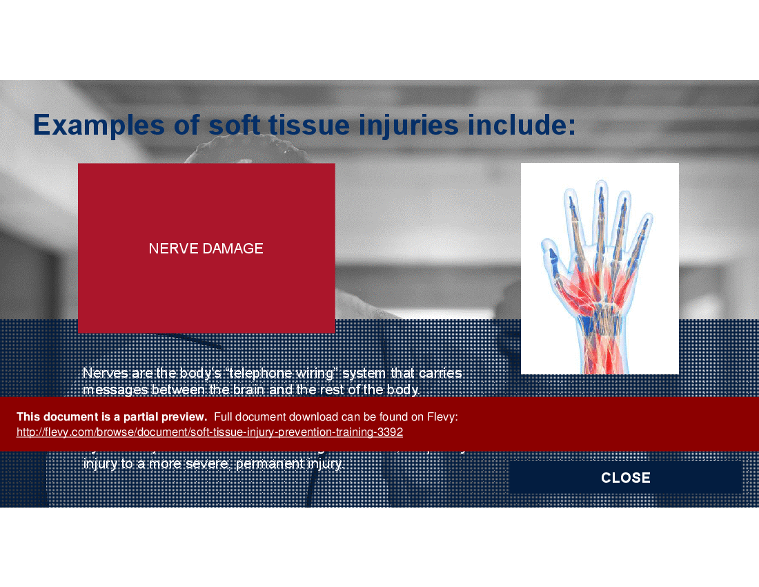 This is a partial preview of Soft Tissue Injury Prevention Training (35-slide PowerPoint presentation (PPTX)). Full document is 35 slides. 